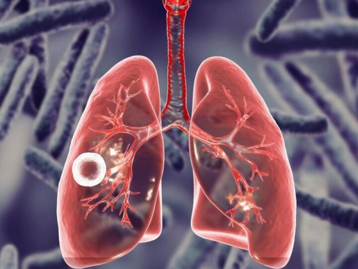 Туберкулездің алдын алу!